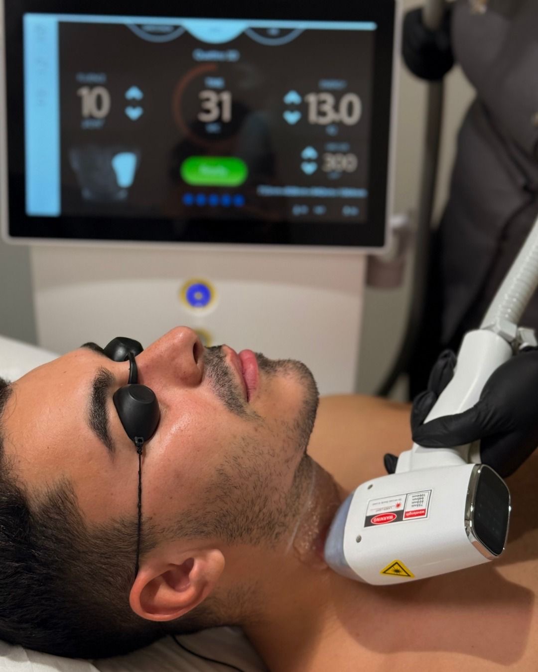 Depilacion laser en piernas completas