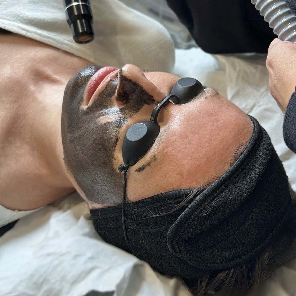Face laser